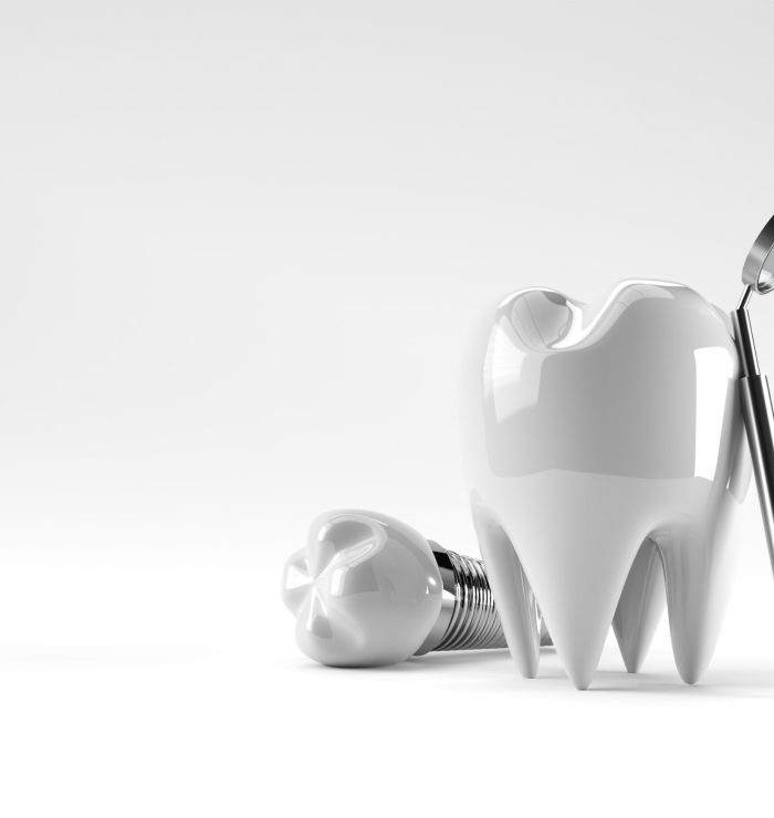 Dental Implants surgery concept 3D Rendering.